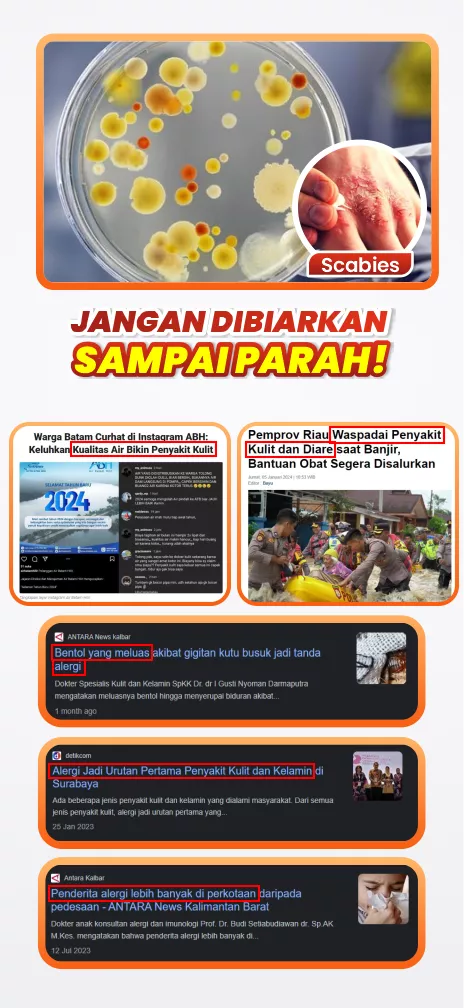 GATAL ALERGI