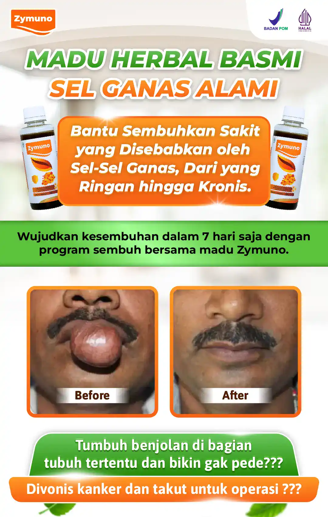 SEL GANAS DALAM TUBUH