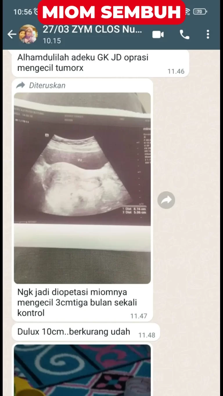 testi-kewanitaan-4.webp